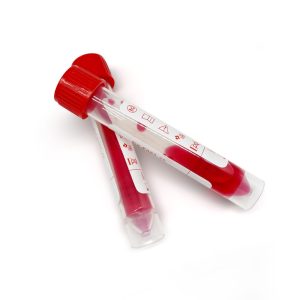 What is a virus sampling tube, what is the func... What is a virus sampling tube, what is the func...